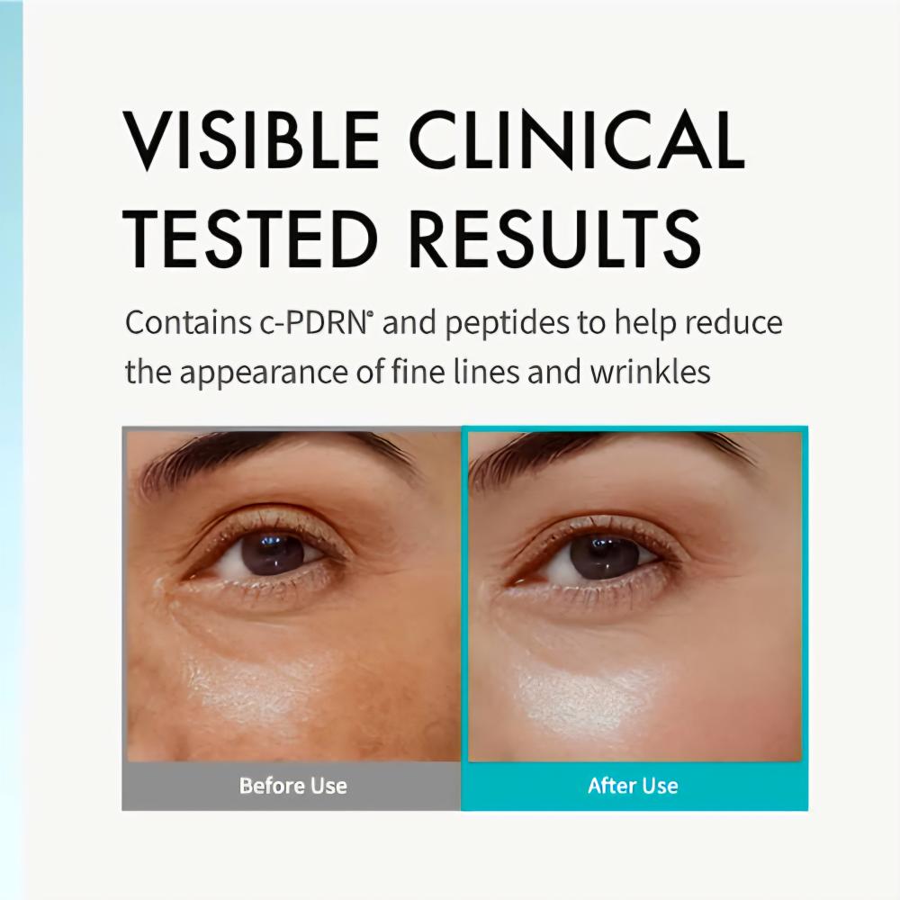 REJURAN Intensive Eye Cream c-PDRN 0,5% 20ml