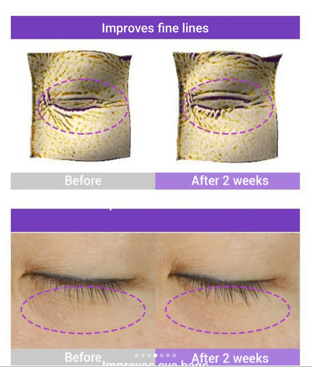 BIOHEAL BOH Probioderm 3D Lifting Eye & Wrinkle Cream 25ml