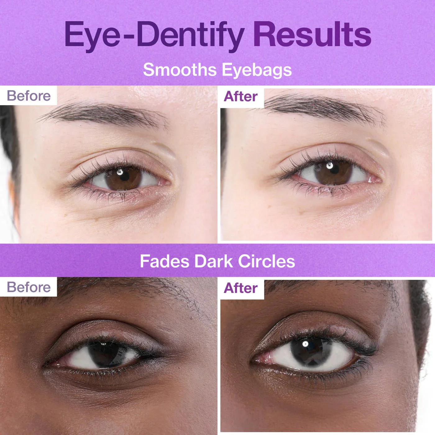 Vanusevastased Liftingupadjad numbuzin No.9 NAD+ Collagen Under Eye Patches 10tk – 4