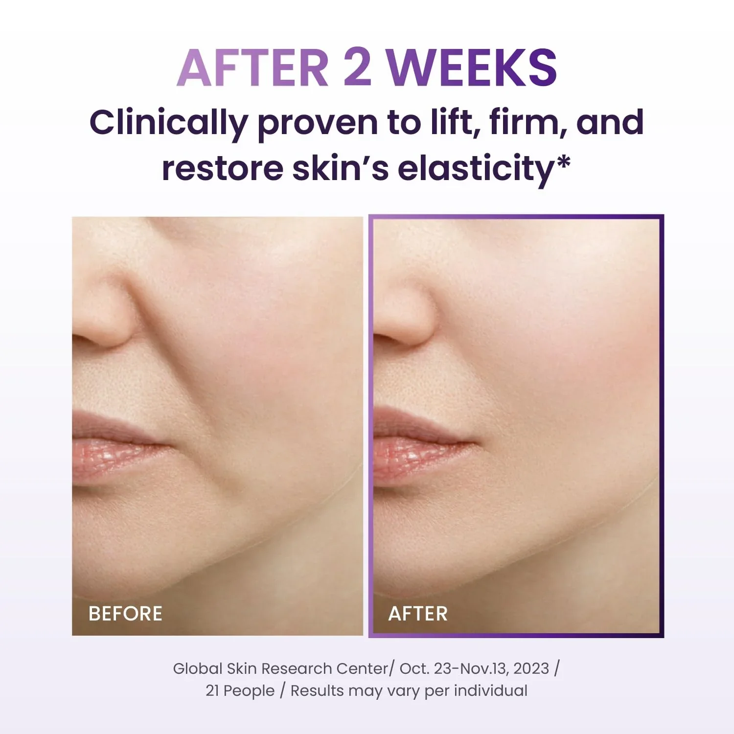 BIOHEAL BOH Probioderm 3D Lifting Ampoule 30ml