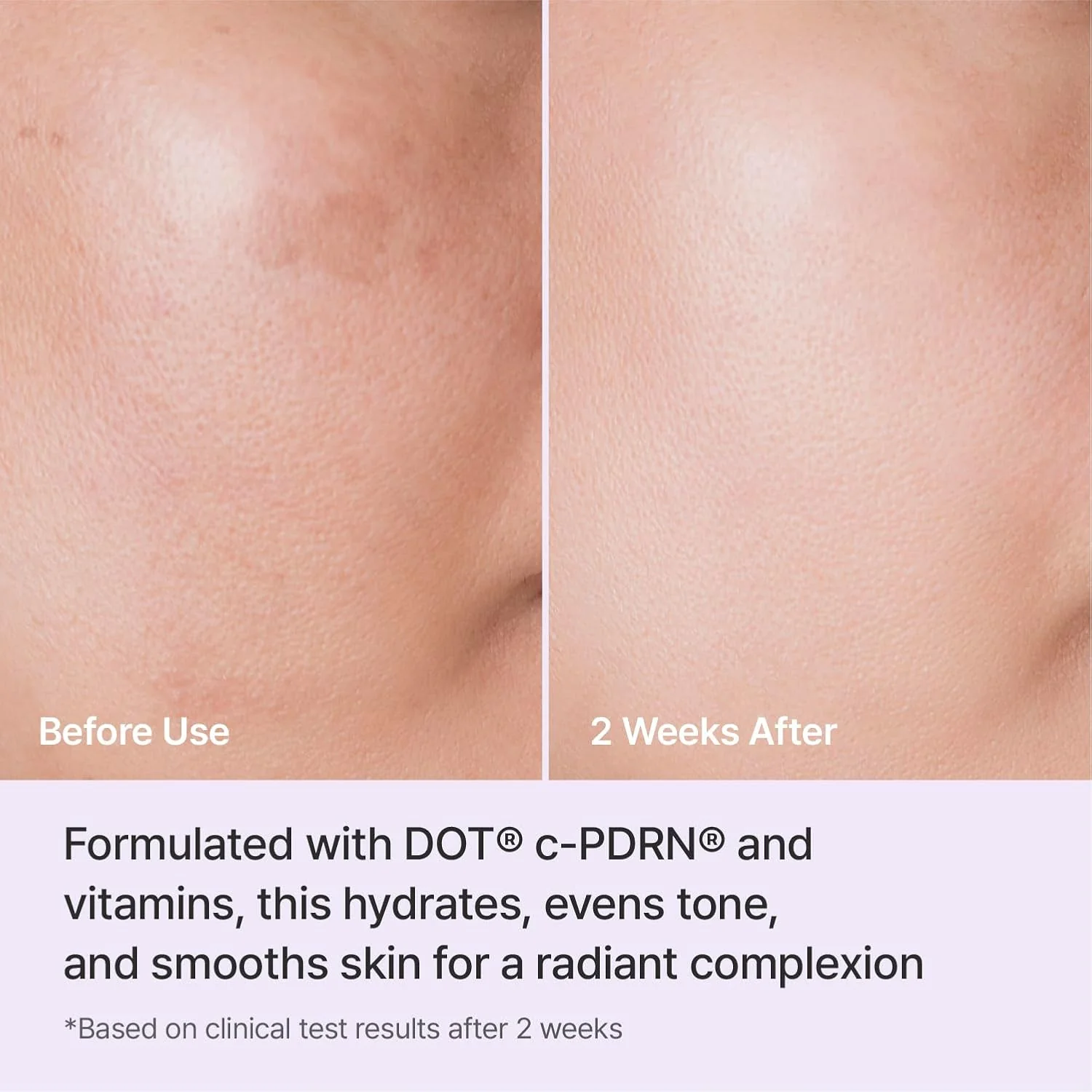 Rejuran Triple Radiance Cream 50ml